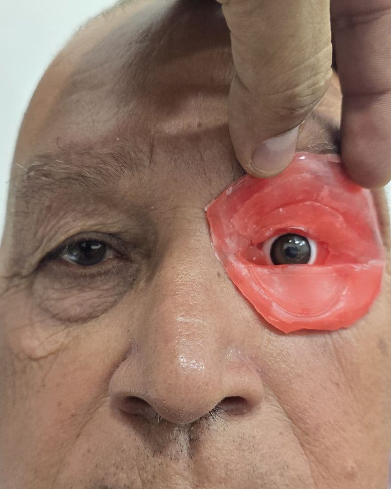Prótesis óculo-palpebral sostenida junto al rostro del paciente para comprobar el color