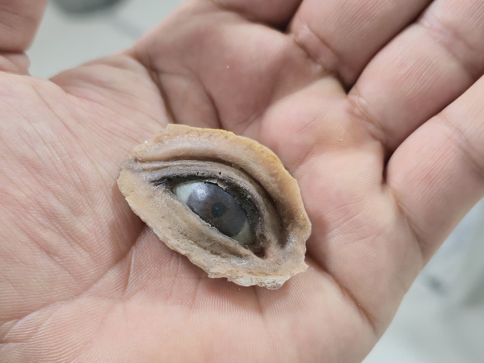 Prótesis óculo-palpebral sostenida en la palma de la mano del doctor